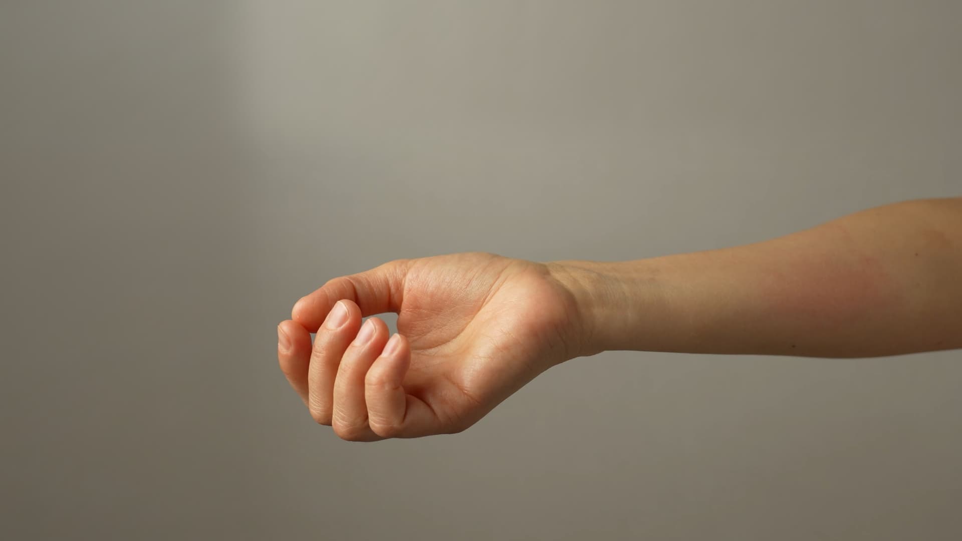 Woman scratching her arm